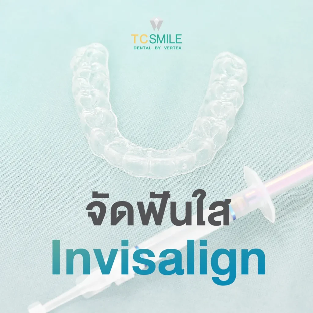 Invisalign