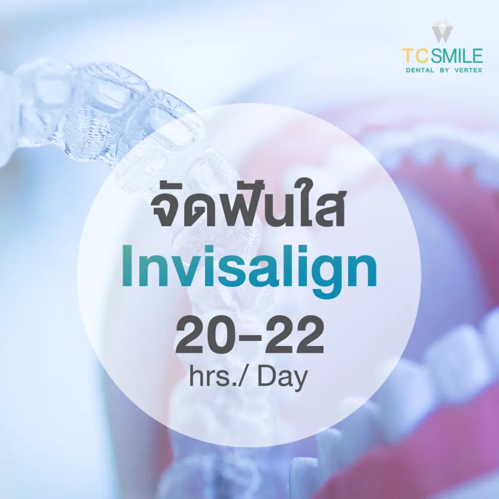 Invisalign
