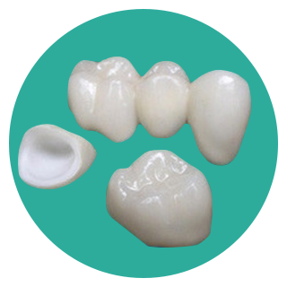 Ceramic-Crown
