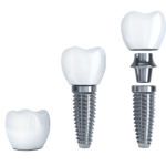 Dental-Implant