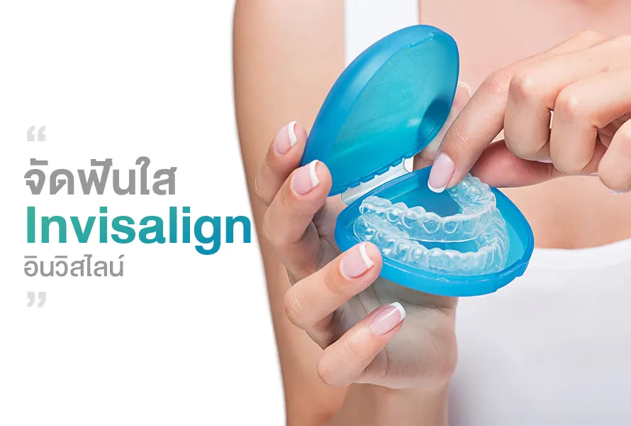 Invisalign