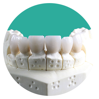Resin-crown