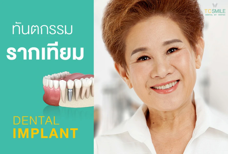 Dental-Implant
