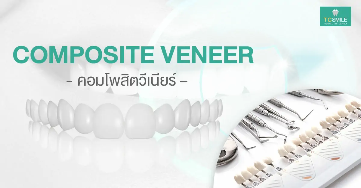 VENEER-white-teeth-beautiful-teeth