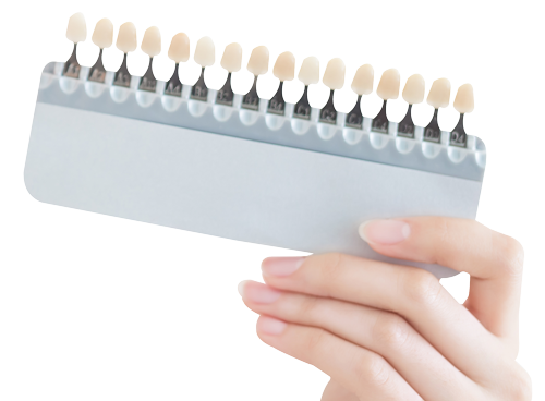 Veneer