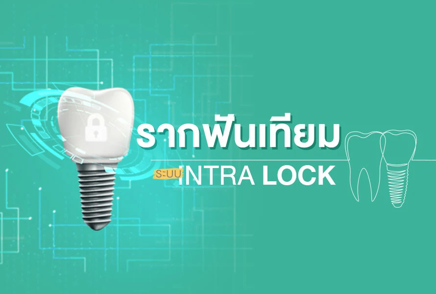 intra-lock