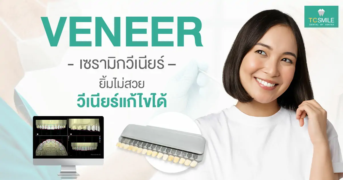 white-teeth-beautiful-teeth-Veneer