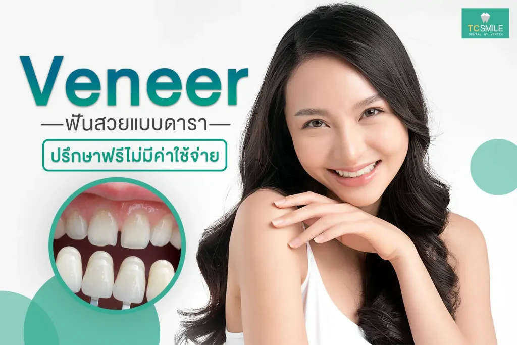 white-teeth-beautiful-teeth-Veneer