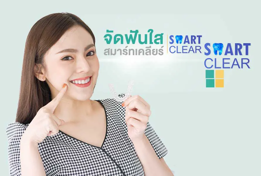 จัดฟัน smart-clear